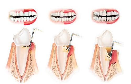 Буйлнаас цус гарах нь ямар аймшигтай үр дүнд хүргэдэг болохыг та мэдэх үү?